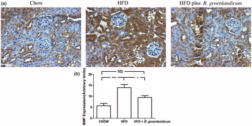 Figure 5. BMF expression is elevated in renal tissues of HFD-fed mice. (a) BMF immunohistochemical (IHC) staining in kidney sections (original magnification ×200). (b) Quantification of BMF IHC staining. Values are expressed in AU as the mean ± SEM, n = 10–12 for each group. *p < 0.05; ***p < 0.001. N.S., not significant.