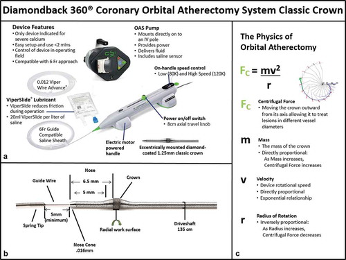 Figure 1. Diamondback 360® coronary orbital atherectomy system (OAS) Classic Crown (1.25mm). (a) OAS device features. (b) Close-up view of the OAS crown, drive shaft, nose cone, and spring tip. (c) The physics of the OAS mechanism of action.