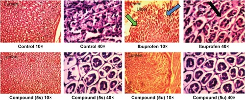 Figure 3 Histopathological study of stomachs of rats treated with standard drug (ibuprofen) and active compounds in comparison to healthy controls.