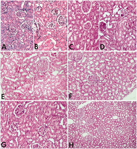 Figure 2. (A) Normal structure of kidney in control group. Haematoxylin and eosin. Magnification 200×. (B) Stained sections of kidney of sham + NS 1000 mg/kg group. Slight degenerations were seen. Haematoxylin and eosin. Magnification 200×. (C) Stained sections of kidney of sham + NAC 140 mg/kg group. Similar appearance to the control group. Haematoxylin and eosin. Magnification 200×. (D) Stained sections of kidney of paracetamol 2 g/kg + NS 250 mg/kg group. Haematoxylin and eosin. Magnification 200×. (E) Paracetamol-administered rat kidney. Severe necrosis, congestion and extravasation of red blood cells were seen. Haematoxylin and eosin. Magnification 200×. (F) Stained sections of kidney of paracetamol 2 g/kg + NS 500 mg/kg. Slightly to mild degenerations were seen. Haematoxylin and eosin. Magnification 200×. (G) Paracetamol 2 g/kg + NAC 140 mg/kg group. Structures of kidney were similar to the control group. Haematoxylin and eosin. Magnification 200×. (H) Paracetamol 2 g/kg + NS 1000 mg/kg group. Structures of kidney were similar to the control group. Haematoxylin and eosin. Magnification 100×.