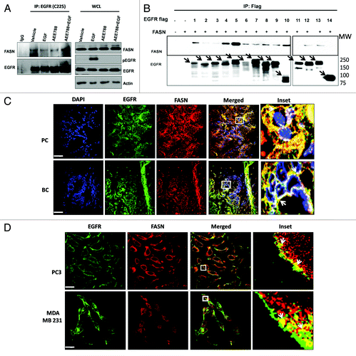 Figure 4. EGFR interacts with FASN independent of EGFR kinase activity. (A) Co-immunoprecipitation of endogenous EGFR (by C225) and endogenous FASN from PC3 cells treated with EGF+/−AEE788 for 30 min. Left panel shows western blot analysis of immunoprecipitated samples and right panel shows the analysis of whole cell lysates (WCL) (B) Co-immunoprecipitation of mutated flag tagged EGFRs (arrows) (using anti-flag antibodies) with exogenous FASN transfected into HEK293T cells. 1, WT EGFR; 2, deletion of 57–68AA (amino acids); 3, deletion of 69–184AA; 4, deletion of 185–337AA; 5, deletion of 338–360AA; 6, deletion of 361–481AA; 7, deletion of 482–496AA; 8, deletion of 497–598AA; 9, deletion of 599–644AA; 10, deletion of 1–644AA; 11, deletion of 645–671AA; 12, deletion of 669–684AA; 13, R817M; 14, deletion of 684–1210AA. (C) Immunofluorescent co-staining of EGFR (green) and FASN (red) in prostate and breast cancer tissues (arrows indicated colocalized EGFR-FASN, bar = 100 μm) (D) Immunofluorescent co-staining of EGFR (green) and FASN (red) in prostate (PC3) and breast (MDA-MB-231) cancer cell lines (arrows indicated colocalized EGFR-FASN, bar = 30 μm).