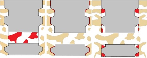 Figure 3 A schematic image of the area of interest in the quantitative histomorphometric analysis.Notes: The measured area of interest is colored red and bone is colored tan. Bone area inside the perforating hole (left), bone–implant contact (middle), and bone area inside threads (right).