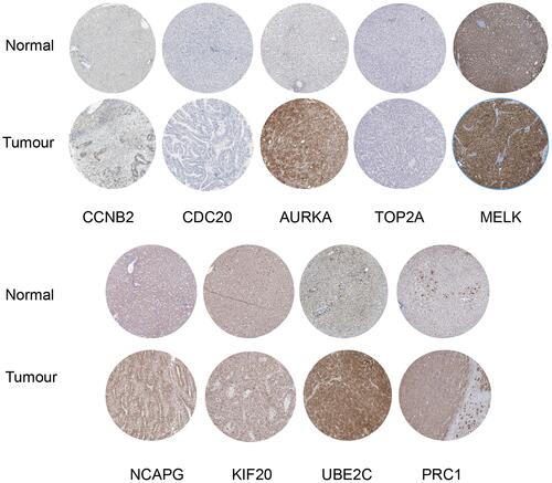 Figure 7 Representative protein expression of the nine hub genes.