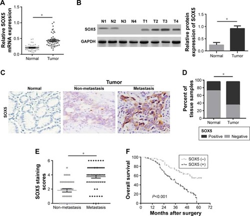 Figure 1 Relative SOX5 expression and its clinical significance in human GC.Notes: (A) qRT-PCR detection of SOX5 mRNA expression in GC tumor tissues and matched normal tissues. (B) Western blot analysis of SOX5 protein expression in GC tumor tissues (T) and adjacent normal tissues (N). (C) Representative IHC images of SOX5 in GC tumor tissues with or without metastasis and corresponding normal tissues. (D) Quantitative assessment of SOX5 expression in GC tumor tissues and paracancerous normal tissues in the light of IHC scores. (E) Scatterplots of the average staining scores of SOX5 expression in patients without or with metastasis. (F) Kaplan–Meier overall survival curves of GC patients with positive or negative SOX5 expression. *P<0.05. Magnification ×200.Abbreviations: SOX5, sex-determining region Y-box protein 5; GC, gastric cancer; qRT-PCR, quantitative real-time PCR; GAPDH, glyceraldehyde-3-phosphate dehydrogenase; IHC, immunohistochemistry.