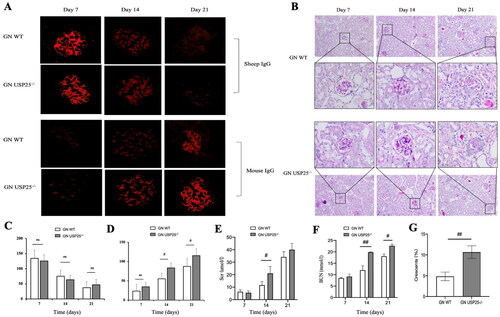 Figure 1. Knockout USP25 aggravated the renal injury in anti-GBM GN: (A) Representative photographs of the deposition of sheep IgG and mouse IgG in the kidneys of WT anti-GBM GN mice and USP25−/− anti-GBM GN mice; (B) pathological changes in renal tissues in wild anti-GBM GN mice and USP25−/− anti-GBM GN mice; (C and D) quantification deposition of sheep IgG and mouse IgG; (E and F) Scr (E) and BUN (F) of USP25−/− anti-GBM GN mice and wild anti-GBM GN mice; (G) the proportion of crescent formation at the day 21. Anti-GBM GN: anti-glomerular basement membrane glomerulonephritis; Scr: serum creatinine; BUN: blood urea nitrogen; WT: wild type; bars represent means ± SEM; n = 5/group; #p < 0.05; ##p < 0.01.