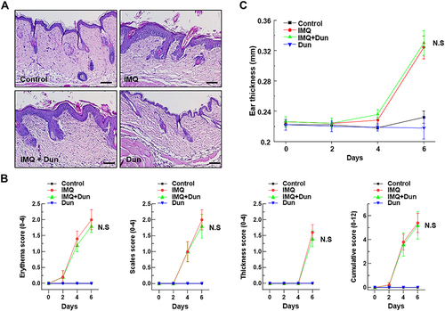 Figure 4 Effect of Dun on IMQ-induced skin inflammation in NQO1−/− mice. Psoriasis was induced by topical application of IMQ. (A) Phenotypical presentation and corresponding histology (H&E staining) of mouse dorsal skin. (B) Erythema, scaling, and thickness of dorsal skin was scored on the indicated days. The cumulative score (erythema plus scaling plus thickness) is presented. Symbols indicate the mean ± S.D. (n = 5). (C) The thickness of the right ear skin was measured on the indicated days (Means ± S.D., n = 5).