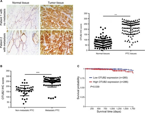 Figure 6 OTUB2 is upregulated in PTC tissues and its level inversely correlates to the prognosis of PTC.Notes: (A) PTC tissues showed significantly higher OTUB2 expression than the adjacent normal tissues. (B) Metastatic PTC tissues (n=38 cases) showed higher OTUB2 expression than non-metastatic tissues (n=60 cases). (C) PTC patients with high OTUB2 expression showed less survival probability than those patients with a low OTUB2 expression as indicated by online data from TCGA. ***P<0.001.Abbreviation: PTC, papillary thyroid carcinoma.