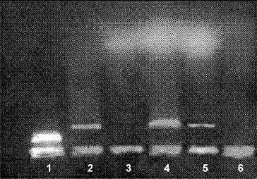 Figure 2. Agarose gel electrophoresis of DNA isolated from rat thymocytes. Lane 1 – DNA; lanes 2 and 4 – Control; lane 3 – chronic morphine treatment; lane 5 – chronic treatment with morphine plus L-NAME; lane 6 – DNA degrading products.