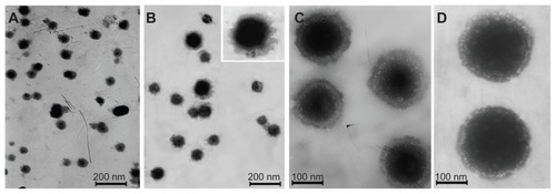 Figure 6 Transmission electron microscopic imaging of different nanoparticles: (A) Protamine (Pro)/deoxyribonucleic acid (DNA) complex, (B) DNA/Pro/DNA complexes, (C) Cationic liposome-coated DNA/Pro/DNA complexes, and (D) o-carboxymethyl-chitosan cationic liposome-coated DNA/Pro/DNA complexes.