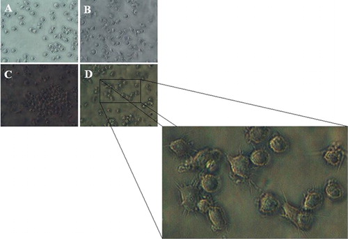 Figure 1. U937 cells at day 14 after transduction: untreated control culture (A); U937 cells infected with backbone of the vector (B); the group that transduced with RV-424 (C and D). The aggregated (C) and adherent (D) monocyte/macrophage-like phenotypes.