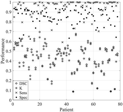 Figure 3. Scatter plot of the Dice similarity coefficient (DSC), kappa (K), sensitivity (Sens) and specificity (Spec) averaged for each patient for the leave-one-out cross-validated LDA model based on all image types with eight neighbour voxels included, using autoscaling as image pre-processing. This model is labelled ‘Best LDA model’ in Figure 2 (see also Table 1, bold).