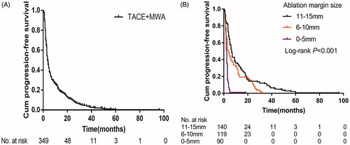 Figure 2. Kaplan-Meier curves of progression-free survival (A) and the progression-free survival stratified by the ablation margin size (B) in all 349 patients with large HCCs after TACE-MWA.