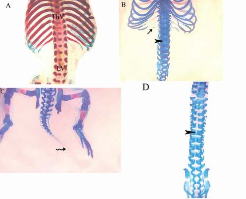 Figure 4. Photographs of the vertebral column and ribs of fetuses at 20th day of gestation (Alcian blue–Alizarin red double stain). (A) Control group: vertebral column showed complete ossification of all vertebrae and normal appearance of ribs. (B, C) LD group: vertebral column showed shortage of the last rib (arrow), and unossified vertebrae (head arrow) and loss of chondrification of some tail vertebrae (wavy arrow). (D) HD group: unossification of vertebral column and centra. (head arrow). ThV = thoracic vertebra and LV = lumbar vertebra