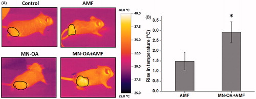 Figure 4. Measurement of tumour surface temperature using an IR camera. (A) Images for temperature rises at the tumour region in mice treated with only AMF and MN-OA + AMF, before and after the therapy. (B) Bar graph of temperature rises at the tumour region for control and treated mice. Values represent mean ± SEM and * indicates that values are significant at p < 0.05.