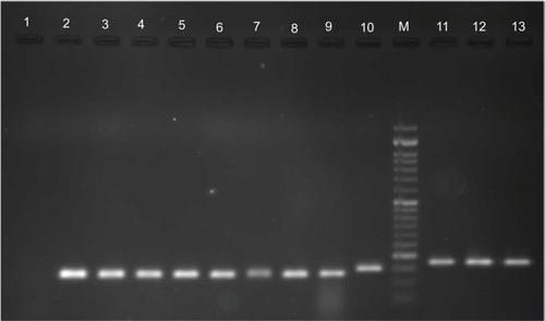 Figure 4 Column M (50 bp DNA ladder); column 1, negative control (distilled water); column 2, positive control; columns 3 to 9, pmrB gene; column 10, 16S rRNA; columns 11 to 13, pmrA gene.