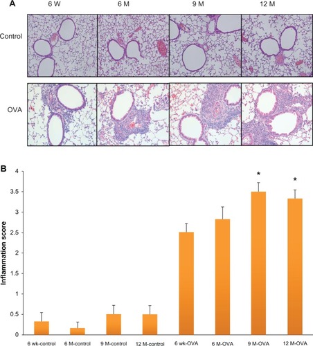 Figure 2 Histologic findings in hematoxylin and eosin staining of the airway (A) and peribronchial inflammation scoring (B) according to age in the acute asthma model.