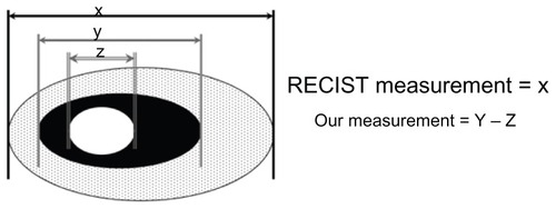 Figure 1 Diagram depicting target lesion measurement by RECIST and NRC.