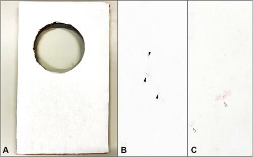 Figure 3 (A) Water-contact indicator tape without any previous water contact. (B) Water-contact indicator tape after exposing to aerosols generated from phacoemulsification machines. Solid triangles showing presence of red-dots after aerosol contacts. (C) Water-contact indicator tape after splashing with fluid drops. White triangles showing red areas on the tape after droplet contacts.