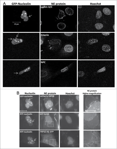 Figure 7. Stress-induced nuclear bubbles are encapsulated by impaired NE. Bax/Bak DKO MEFs were co-transfected with the expression vectors corresponding to FLAG-Bax together with RFP-nucleolin or GFP-nucleolin alone (for assessing endogenous NE proteins) and each of the indicated fluorescence versions of NE-associated proteins (for assessing nuclear bubble encapsulation) in the presence of 20 μM Q-VD-OPH. The cells were fixed and stained with Hoechst 33258 dye (to detect the nuclei) 24 h after transfection. The endogenous proteins were detected by their corresponding antibodies. Mab414 antibody was used to detect NPCs. The images of the endogenous proteins (A) were detected by confocal fluorescence microscopy and those of the overexpressed proteins (B) by epi-fluorescence microscopy. The images in each row represent the same field visualized separately for detection of RFP/GFP-nucleolin, the indicated NE protein and Hoechst-stained nuclei. Higher magnifications of the dashed boxed areas in the NE protein panel, which contain the bubble-budding sites, are shown in the right panel (B). Arrows indicate the position of the bubbles. Presented results are from representative experiments (each, out of at least 3 independent experiments). Bar = 20 μm or 10 μm for the low and high magnifications, respectively.