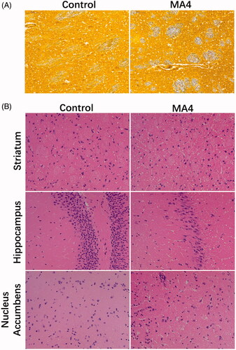 Figure 1. The effects of METH on neurons and axons. (A) Glees silver staining revealed the morphological changes of axons in the striatum. (B) HE staining showed the pathological changes in the striatum, hippocampus, and nucleus accumbens.