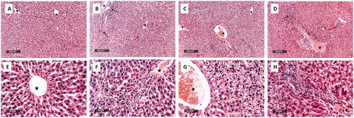 Figure 11. Histological examination of the rat liver of:The positive control group (A and E) showed normal histological features of the liver parenchyma with many apparent intact well-organized hepatocytes, intact subcellular details (arrow), and intact hepatic vasculatures (star).The negative control group (B and F) showed multiple pericentral focal areas of hepatocellular necrosis with mononuclear cells infiltrates (red arrow) with severe periportal mixed inflammatory cell infiltrates. In addition, there are abundant neutrophils (black arrow) and moderate dilatation and congestion of hepatic blood vessels (star).The ZnO-NPs treated infected group (C and G) showed mild dilatation of the hepatic blood vessels (star) with few lobular vacuolar degenerative changes (red arrow) and minimal records of inflammatory cells infiltrate.The gentamicin-treated infected group (D and H) showed well-organized morphological features of the hepatic parenchyma with almost intact hepatocytes (black arrow). Nevertheless, mildly congested blood vessels were observed (star) with scattered few focal areas of necrosis (red arrow) and mild inflammatory cell infiltrates (dashed arrow). 