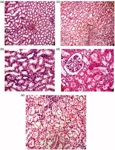 Figure 3. Photomicrograph of kidney (a) control group (b) ACEI group (c) EPO + ACEI group (d) ASP group (e) ASP + ACEI group (200 and 400X, H&E Staining).