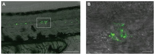 Figure 2 Fluorescent mesoporous silica nanoparticle (MSNP)-injected zebrafish embryos. (A) MSNPs (green) distributed anteriorly and caudally from site of injection (boxed area); the black cells are pigment cells (melanocytes). Scale bar = 100 μm. (B) MSNPs aggregated at the site of injection. Scale bar = 20 μm.