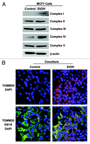 Figure 7. Ethanol increases the mitochondrial activity in MCF7 cancer cells. (A) MCF7 cells were cultured in the presence or in the absence of 100 mM EtOH for 72 h. Western blot analysis using antibodies against subunits of the mitochondrial OXPHOS respiratory chain (complexes I–V). β-actin is shown as equal loading control. Note that ethanol significantly increases the expression of OXPHOS complex I (20 kDa subunit) and IV (COX-II) in MCF7 cancer cells. (B) Immunocytochemistry. MCF7 cell-fibroblast co-cultures were treated with 100 mM EtOH for 72 h. Cells were fixed and immunostained with antibodies against the mitochondrial membrane marker TOMM20 and K8/18. Nuclei were counterstained with DAPI (blue). The upper panels show the mitochondrial staining (red). The bottom panels show also the K8/18 staining (green), to identify the MCF7 cell population. Note that ethanol increases the mitochondrial mass specifically in MCF7 cells, as compared with untreated cells. However, ethanol does not promote mitochondrial biogenesis in fibroblasts. Original magnification, 40x.