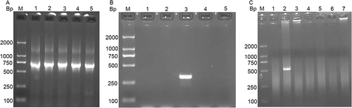 Figure 2 Agarose gel electrophoresis results of 23S rRNA RT-PCR, tet(M), and tet(C) PCR products. (A) Lane M is the DNA marker, lane 1 is the 23S rRNA detection of the reference strain, and lanes 2–5 are the 23S rRNA detection of the four different clinical isolates. (B) Lane M is the DNA marker, lanes 1–2 and 4–5 are the clinical strains which are negative for tet(M) and lane 3 is the control strain which is positive for tet(M). (C) Lane M is the DNA marker, lanes 1 and 3–7 are the clinical strains which are negative for tet(C) and lane 2 is the positive control of tetracycline-resistant Chlamydia suis MS08 strain which is positive for tet(C).