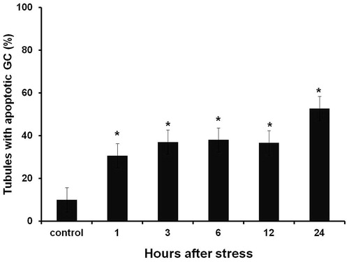 Figure 1. Percentage of seminiferous tubules with TUNEL-positive cells at different experimental times after a single stressor exposure. Percentages were significantly higher than those observed in control groups from the first hour until reaching a peak 24 hours after acute stress induction. Data shown as Mean ± SEM and subjected to one-way ANOVA and Newman-Keulls analysis. *p < 0.01 vs. control group.