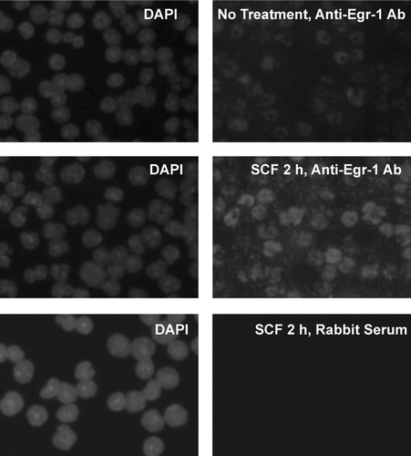 FIG. 2 SCF-induced Egr-1 expression as determined by immunofluorescence staining. Mouse BMMCs from C57/BL6 mice were stimulated with SCF (100 ng/mL) for 2 hr or left untreated (no treatment). Cells were fixed, permeabilized, and then stained with anti–Egr-1 Ab or control rabbit serum. Alexa 594-conjugated goat anti–rabbit IgG F(ab′)2 was used as a secondary Ab. DAPI staining was carried out to visualize the nucleus of the cells. SCF stimulation induced expression of Egr-1, which is localized in the nucleus of the cells. Original magnification, × 40. Immunolabeled specimens were mounted in DAPI containing Vectashield (Vector Laboratories, Burlingame, CA). Cells were examined using a fluorescence microscope (Nikon E600; Nikon, Tokyo, Japan) equipped with a DMX1200 camera and a CFI Plan-Fluor DDL 40 × /0.75 objective lens. Images were processed using Adobe Photoshop 5.0 (Adobe Systems, San Jose, CA).