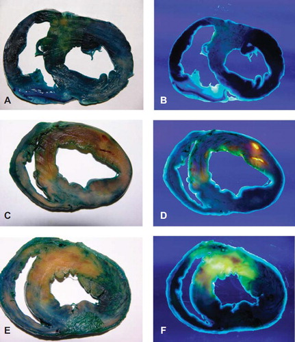 Figure 1. Excised heart stained with Evans blue dye and thioflavin-S. Normal myocardium, reperfusion area, and NRA were dark blue, yellow, and dark red, respectively, in room light (A,C,E), while black, bright yellow, and deep red, respectively, in UV light (B,D,F). A,B: sham-operation group; C,D: control group; E,F: garlicin group.