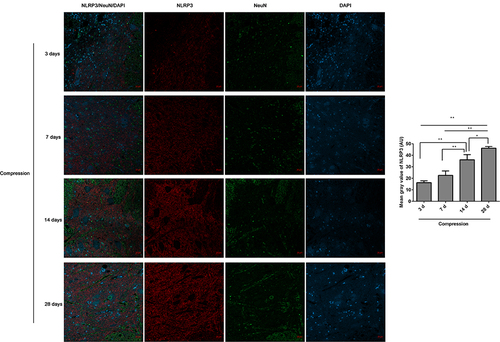 Figure 2 The expression of NLRP3/NeuN in the anterior horn of lesioned spinal cord following compression was analyzed by immunofluorescence. The mean fluorescence intensities of NLRP3 were analyzed by Image J software, and represented as mean gray values. *P<0.05, **P<0.01.