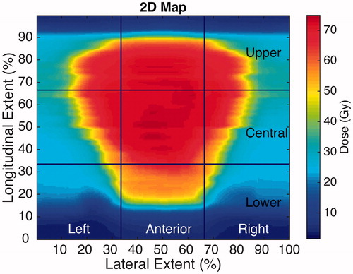 Figure 1. An illustration of the segments division in the generated 2D maps. Left and right sectors are combined to create the different posterior sectors: posterior, posterior upper, posterior central and posterior lower. Note: lateral edges represent the posterior line of the rectum.