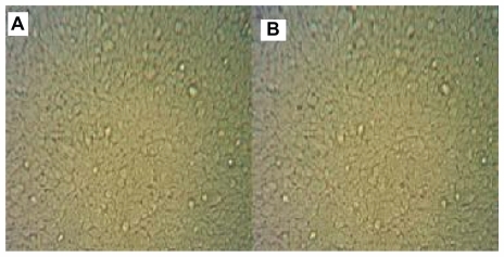 Figure 4 (A) HER2-negative HeLaS3 cells treated with anti-HER2 immunonanoshells. (B) No cytotoxicity was observed in HeLaS3 cells following near-infrared laser treatment.