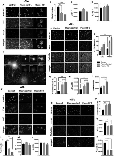 Figure 4. Plasma from obese rats induces damage in a mouse brain endothelial cell line. Endothelial cells were treated with plasma from obese rats (A). The number of nuclei (B) and the fluorescence intensity of ZO-1 (C) and IL-1β (D) were evaluated. *P < 0.05 **p < 0.01 and ***P < 0.001. Data are presented as the mean ± SEM (n = 3).