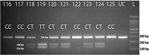 Figure 1 PCR-RFLP product of the MTHFR C665t genotype which was digested with the HinF1 enzyme.