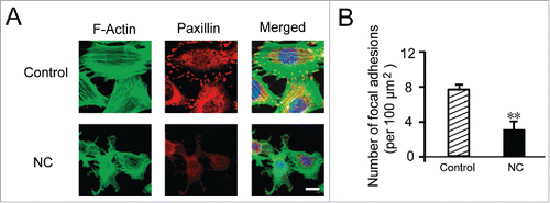 FIGURE 5. Effects of NC on cytoskeletal system of HUVECs. (A) HUVECs were treated with 7 mM NC or medium alone (untreated control) for 16 h. HUVECs were fixed and stained with phalloidin for F-actin, and anti-paxillin antibody for paxillin, respectively. (B) Number of adhesion sites were analyzed. Data are expressed as means ± SD of three independent experiments. Statistical significance is expressed as **, P<0.001; versus untreated control. Scale bar indicates 50 µm.