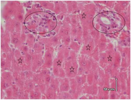 Figure 6. Paraffin sections stained by haematoxylin and eosin (H&E) for histopathological examination of liver tissues of rats treated with APAP (500 mg/kg) and RA (10 mg/kg). There are still some regions of injury induced by APAP. Circles show inflammatory cell infiltrations and asterisks indicate hepatic cell necrosis.