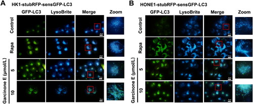 Figure 9. Effect of garcinone E on autophagosome-lysosome fusion in HK1 and HONE1 cells by co-localization analysis of sensGFP-LC3 and LysoBrite Blue. (A, B) Fluorescence photographs showed the co-localization of GFP-LC3 and LysoBrite Blue in human NPC cells. HK1-stubRFP-sensGFP-LC3 and HONE1-stubRFP-sensGFP-LC3 cells were treated with garcinone E (5 and 10 μmol/L) or 0.5 μmol/L rapamycin (Rapa) for 48 h and then stained with LysoBrite Blue. Autophagosomes present as green puncta, while lysosomes appear as blue puncta. The boxed regions in the left panels are enlarged in the right panel. Scale bar: 20 μm.