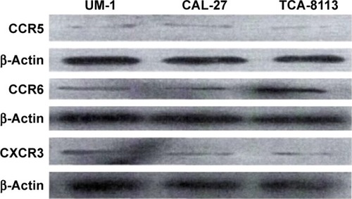 Figure 2 Expression of CCR5, CCR6, and CXCR3 in three human tongue squamous cell carcinoma cell lines (CAL-27, UM-1, and TCA-8113) by Western blot.