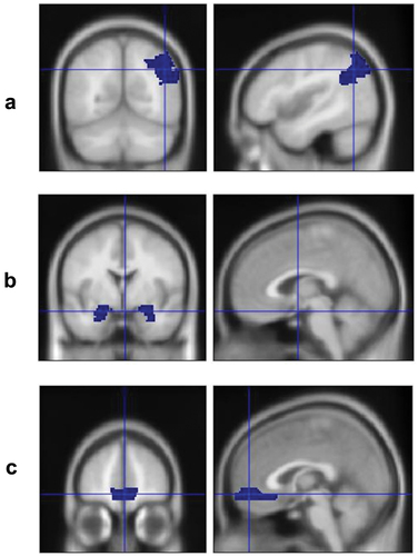 Figure 3. Anatomically defined right angular gyrus (a), amygdala (b), and vmPFC (c).