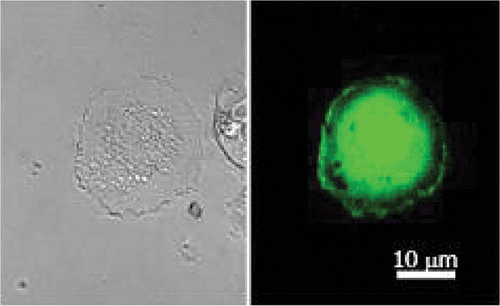Figure 4. Confocal microscopy photograph of sonoporated human glioblastoma (U87-MG) cells. Cells were treated with plasmid encoding GFP gene in the presence of BRIU® microbubbles (20 bubbles per cell) and insonate during 1 min at 1 MHz, 310 kPa and 40% DC. (Right) GFP image; (left) phase contrast image.