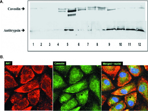 Figure 5 Co-localization of caveolin and AAT. (A) Western Blot of 12 membrane fractions derived from endothelial cells incubated with AAT (5 μ M, 18 hours) and probed with anti-Caveolin (upper panel) and anti-AAT (lower panel) antibodies is presented. Both AAT and caveolin are abundant in Lane 5 (5th fraction). AAT is also detected in fractions 9–12 where G-protein-coupled receptor (GPCR) binding components usually appear. Shown is a representative blot from 3 experiments. (B) Confocal microscopy images of AAT treated (5 μ M, 18 hours) PAEC were taken at 1000× magnification. Binding of primary antibodies to AAT and caveolin was visualized using Rhodamine- and FITC-conjugated secondary antibodies for AAT and caveolin, respectively. Yellow areas within the cells indicate co-localization of AAT and caveolin. Three identical experiments were performed.