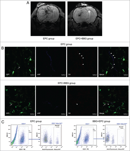 Figure 5. P2X7 receptors modulated exogenous EPCs integrating into the vessels containing the tumor-derived endothelial cells (ECs). (A) Representative susceptibility-weighted imaging (SWI) of glioma-bearing rats in EPC group or EPC +BBG group. Hypointensity accumulated in the region of rich-vessels. (B) Representative images of exogenous EPCs, tumor-derived ECs and regular ECs lined the vessel lumen in gliomas of groups with or without BBG treatment. EPCs (arrowheads) were labeled with DiI (red) but also expressed EC marker vWF (blue). In contrast, tumor derived-ECs (arrows) expressed both the GFP (green) and vWF, and regular ECs only expressed vWF. Scale bar: 20 μm. (C) Representative results of flow cytometry for dissociated glioma tissue in groups with or without BBG treatment. In EPC group, ECs were CD31+ and constituted 14.6% of the whole tumor (left), and CD31+ Alex 647+ (exogenous EPCs) represented 9.19% of total ECs (right). While, in EPC + BBG group, ECs were CD31+ and constituted 12.0% of the whole tumor (left), and CD31+ Alex 647+ (exogenous EPCs) represented 3.63% of total ECs (right).