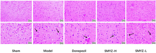Figure 3 Effect on the pathomorphology of the cerebral cortex from rats assessed using HE staining at 8 weeks after the SMYZD intervention. Inflammatory cells and chronic ischaemic changes are labelled with black arrows (bar=50 μm).
