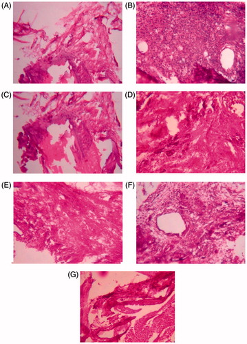 Figure 1. Histopathology of proximal interphalangeal joints on adjuvant-induced arthritic rats. (A) Group I normal control; (B) group II negative control; (C) group III positive control; (D) group IV ESBCI (28 days treatment); (E) group V ESCI (28 days treatment); (F) group VI ESBCI (14 days treatment); (G) group VI ESCI (14 days treatment).