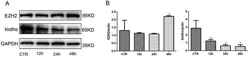 Figure 2. EZH2 was upregulated and klotho was downregulated significantly when HPMCs were stimulated with 2.5% HG for 48 h. (A) WB showed that high glucose increased the expression of EZH2 and decreased the expression of klotho in HPMCs when stimulated for 48 h. (B) Quantitative analysis of the data shown in A (Data are the mean ± SD, *p < .05 vs. the CTR group, n = 3).