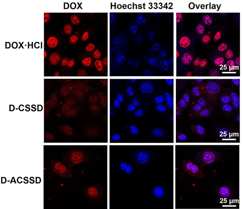 Figure 4 CLSM images of DOX·HCl, D-CSSD and D-ACSSD micelles incubated in 4T1 cells for 4 h.
