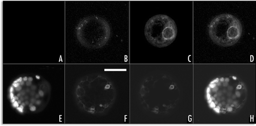 Figure 6 GFP-H3M fluorescence colocalised with FM4-64 staining: (A–D) protoplast expressing the GFP-H3M for 6 hours, (A) chlorophyll auto fluorescence, (B) FM4-64 fluorescence, (C) GFP fluorescence, (D) merge of the four channels; (E–H) protoplast expressing the GFP-H3M for 24 hours, (E) chlorophyll auto fluorescence, (F) FM4-64 fluorescence, (G) GFP fluorescence, (H) merge of the four channels. Scale bar = 20µ.